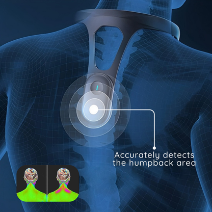 Smart Posture Corrector